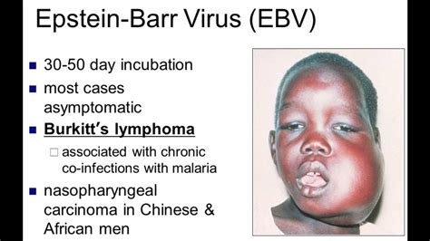 what is burkin|burkins lymphoma.